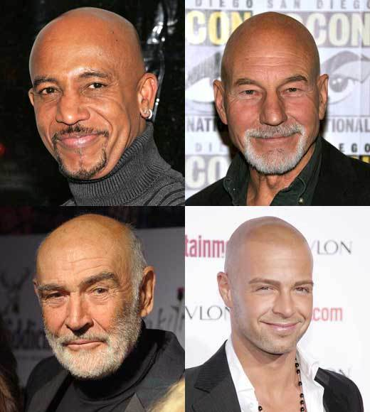 shiny bald head