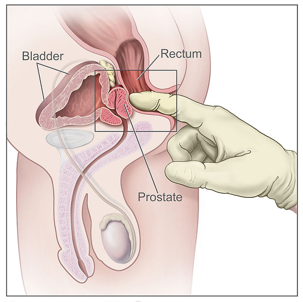 prostate health gland in men